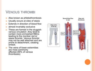 VENOUS THROMBI
 Also known as phlebothrombosis
 Usually occurs at sites of stasis
 Extends in direction of blood flow
 almost invariably occlusive
 These are formed in the sluggish
venous circulation ,they tend to
contain more enmeshed RBCs
leading to the moniker red or
stasis thrombi. Venous thrombi
may not be well attached and are
prone to detachment, creating
emboli.
 The veins of lower extremities
are most commonly
affected.(90% of venous
thrombosis)
 