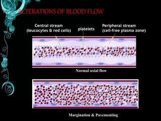 ALTERATIONS OF BLOOD FLOW
Central stream
(leucocytes & red cells) platelets
Peripheral stream
(cell-free plasma zone)
Normal axial flow
Margination & Pavementing
 