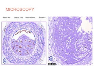 MICROSCOPY
 