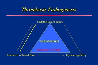 Thrombosis Pathogenesis
Thrombosis Pathogenesis
Alteration of blood flow Hypercoagubility
Virchow’s Triad
Endothelial cell injury
THROMBOSIS
 