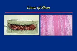 Lines of Zhan
Lines of Zhan
 