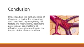 Conclusion
Understanding the pathogenesis of
thrombosis is vital for prevention
and treatment. By recognizing risk
factors and mechanisms, healthcare
professionals can implement
effective strategies to mitigate the
impact of this serious condition.
 