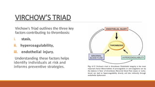 VIRCHOW’S TRIAD
Virchow's Triad outlines the three key
factors contributing to thrombosis:
i. stasis,
ii. hypercoagulability,
iii. endothelial injury.
Understanding these factors helps
identify individuals at risk and
informs preventive strategies.
 