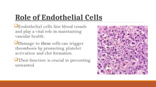 Role of Endothelial Cells
Endothelial cells line blood vessels
and play a vital role in maintaining
vascular health.
Damage to these cells can trigger
thrombosis by promoting platelet
activation and clot formation.
Their function is crucial in preventing
unwanted
 