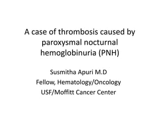 A case of thrombosis caused by
paroxysmal nocturnal
hemoglobinuria (PNH)
Susmitha Apuri M.D
Fellow, Hematology/Oncology
USF/Moffitt Cancer Center
 