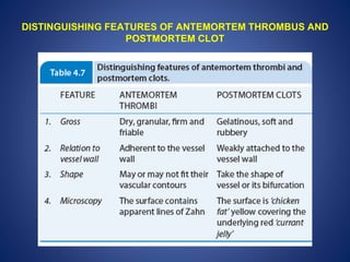 Thrombosis complete | PPTX