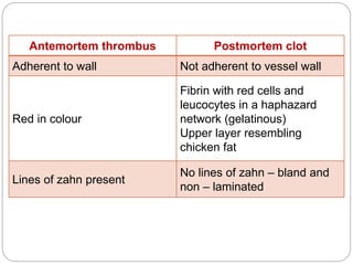 Antemortem thrombus Postmortem clot
Adherent to wall Not adherent to vessel wall
Red in colour
Fibrin with red cells and
leucocytes in a haphazard
network (gelatinous)
Upper layer resembling
chicken fat
Lines of zahn present
No lines of zahn – bland and
non – laminated
 