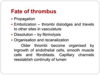 Fate of thrombus
 Propagation
 Embolization – thrombi dislodges and travels
to other sites in vasculature
 Dissolution – by fibrinolysis
 Organisation and recanalization
Older thrombi become organised by
ingrowth of endothelial cells, smooth muscle
cells and fibroblasts. Capillary channels
reestablish continuity of lumen
 