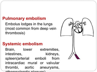 Pulmonary embolism
Embolus lodges in the lungs
(most common from deep vein
thrombosis)
Systemic embolism
Brain, lower extremities,
intestines, kidneys,
spleen(arterial emboli from
intracardiac mural or valvular
thrombi, aortic aneurysms,
 