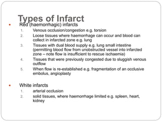 Types of Infarct
 Red (haemorrhagic) infarcts
1. Venous occlusion/congestion e.g. torsion
2. Loose tissues where haemorrhage can occur and blood can
collect in infarcted zone e.g. lung
3. Tissues with dual blood supply e.g. lung small intestine
(permitting blood flow from unobstructed vessel into infarcted
zone – note flow is insufficient to rescue ischaemia)
4. Tissues that were previously congested due to sluggish venous
outflow
5. When flow is re-established e.g. fragmentation of an occlusive
embolus, angioplasty
 White infarcts
1. arterial occlusion
2. solid tissues, where haemorrhage limited e.g. spleen, heart,
kidney
 