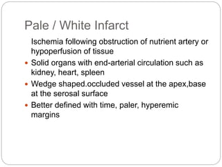 Pale / White Infarct
Ischemia following obstruction of nutrient artery or
hypoperfusion of tissue
 Solid organs with end-arterial circulation such as
kidney, heart, spleen
 Wedge shaped.occluded vessel at the apex,base
at the serosal surface
 Better defined with time, paler, hyperemic
margins
 