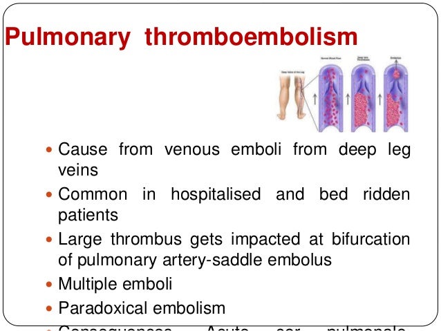 Pulmonary Embolism Definition In Urdu