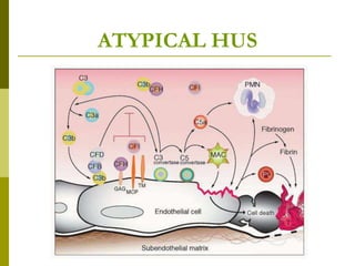 ATYPICAL HUS
 