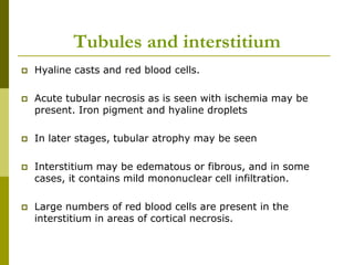 Tubules and interstitium
 Hyaline casts and red blood cells.
 Acute tubular necrosis as is seen with ischemia may be
present. Iron pigment and hyaline droplets
 In later stages, tubular atrophy may be seen
 Interstitium may be edematous or fibrous, and in some
cases, it contains mild mononuclear cell infiltration.
 Large numbers of red blood cells are present in the
interstitium in areas of cortical necrosis.
 