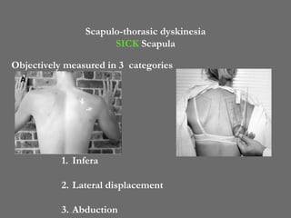 Sickscapula Thrower's shoulder ppt | PPTX