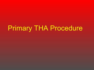 Primary THA Procedure
 