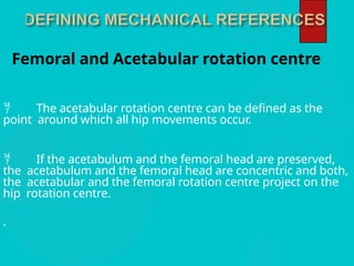 Pre op templating of Total hip replacement | PPTX