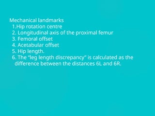 Pre op templating of Total hip replacement | PPTX
