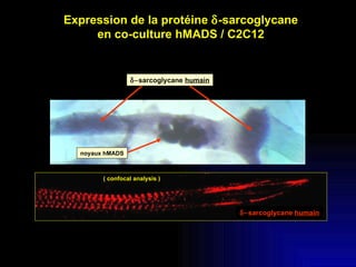 noyaux hMADS  sarcoglycane  humain ( confocal analysis ) Expression de la protéine   -sarcoglycane en co-culture hMADS / C2C12  sarcoglycane  humain 