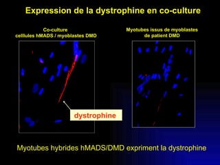 Expression de la dystrophine en co-culture Myotubes hybrides hMADS/DMD expriment la dystrophine Myotubes issus de myoblastes de patient DMD Co-culture  celllules hMADS / myoblastes DMD dystrophine  
