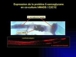 noyaux hMADS  sarcoglycane  humain ( confocal analysis ) Expression de la protéine   -sarcoglycane en co-culture hMADS ...