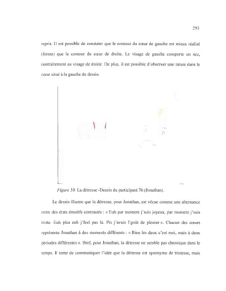 293
repris. Il est possible de constater que le contour du cœur de gauche est mieux réalisé
(forme) que le contour du cœur de droite. Le visage de gauche comporte un nez,
contrairement au visage de droite. De plus, il est possible d'observer une rature dans le
cœur situé à la gauche du dessin.
, (
Figure 50. La détresse -Dessin du participant 76 (Jonathan).
Le dessin illustre que la détresse, pour Jonathan, est vécue comme une alternance
entre des états émotifs contrastés: «Euh par moment j'suis joyeux, par moment j'suis
triste. Euh plus euh j'feel pas là. Pis j'avais l'goût de pleurer». Chacun des cœurs
représente Jonathan à des moments différents: « Bien les deux c'est moi, mais à deux
périodes différentes ». Bref, pour Jonathan, la détresse ne semble pas chronique dans le
temps. Il tente de communiquer l'idée que la détresse est synonyme de tristesse, mais
 