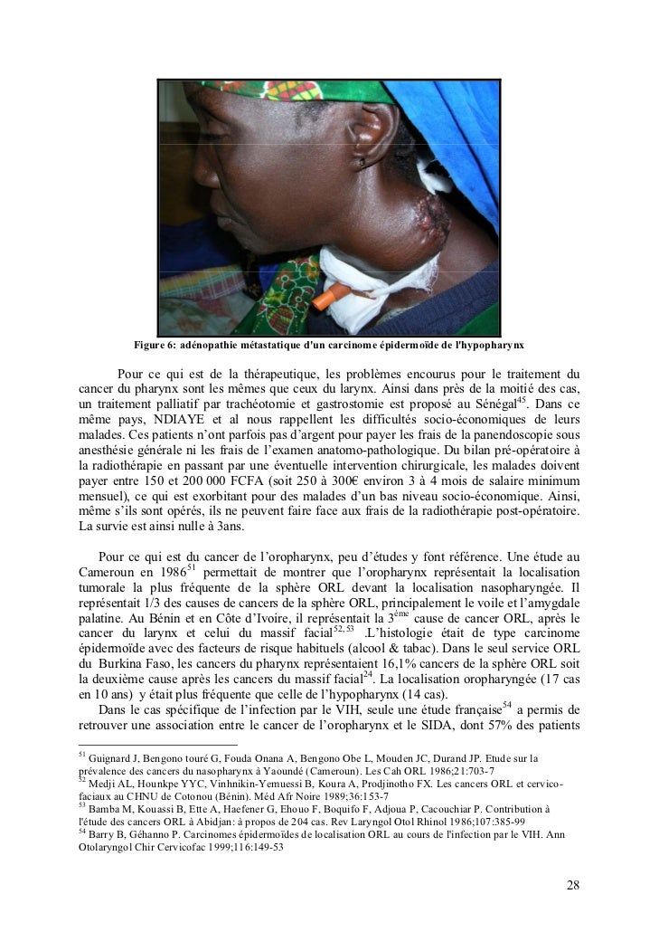 Md thesis meaning picture