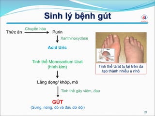 Sinh lý bệnh gút
21
Thức ăn Purin
Acid Uric
GÚT
(Sưng, nóng, đỏ và đau dữ dội)
Tinh thể Monosodium Urat
(hình kim)
Chuyển hóa
Xanthinoxydase
Lắng đọng/ khớp, mô
Tinh thể Urat tụ lại trên da
tạo thành nhiều u nhỏ
Tinh thể gây viêm, đau
 