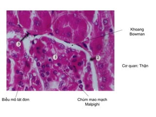 Biểu mô lát đơn
Khoang
Bowman
Chùm mao mạch
Malpighi
Cơ quan: Thận
 