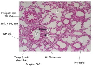 Ti?u ph? qu?n
chnh th?c
C? Reissessen
Ph? nang
Ph? qu?n gian
ti?u thy
?M ph?i
C? quan: Ph?i
Bi?u m? tr? ??n
 