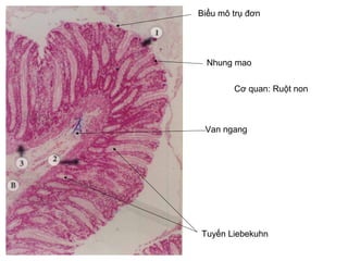 Van ngang
Nhung mao
Bi?u m? tr? ??n
Tuy?n Liebekuhn
C? quan: Ru?t non
 