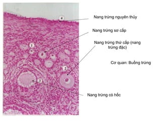 Nang tr?ng nguyn th?y
Nang tr?ng s? c?p
Nang tr?ng th? c?p (nang
tr?ng ??c)
Nang tr?ng c h?c
C? quan: Bu?ng tr?ng
 