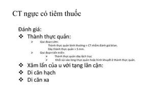 CT ngực có tiêm thuốc
 