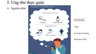 3. Ung thư thực quản
A. Nguyên nhân
NITROSAMIN
Bỏng
Xơ cứng bì hệ thống
Tylosis gen 17q25
 