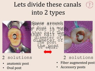 post and core techniques, materials and trouble shooting | PPTX
