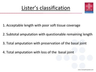 Lister’s classification
1. Acceptable length with poor soft tissue coverage
2. Subtotal amputation with questionable remaining length
3. Total amputation with preservation of the basal joint
4. Total amputation with loss of the basal joint
 