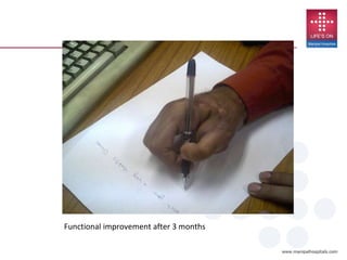Functional improvement after 3 months
 