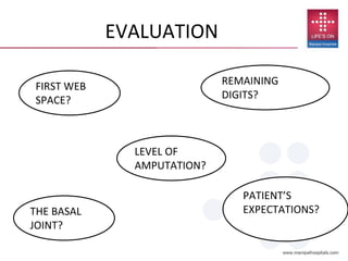 EVALUATION
LEVEL OF
AMPUTATION?
THE BASAL
JOINT?
REMAINING
DIGITS?
PATIENT’S
EXPECTATIONS?
FIRST WEB
SPACE?
 