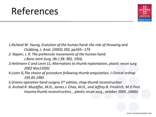 References
1.Richard W. Young, Evolution of the human hand: the role of throwing and
Clubbing, J. Anat. (2003) 202, pp165– 174
2. Napier, J. R. The prehensile movements of the human hand.
J.Bone Joint Surg. (Br.) 38: 902, 1956.
3.Heitmann C and Levin LS, Alternatives to thumb replantation, plastic recon surg
2002 Nov110(6)
4.Lister G,The choice of procedure following thumb amputation, J Clinical orthop
195.85.1985
5.Greens operative hand surgery 5th edition, chap-thumb reconstruction
6. Arshad R. Muzaffar, M.D., James J. Chao, M.D., and Jeffrey B. Freidrich, M.D.Post
trauma thumb reconstruction, , plastic recon surg , october 2005 ,104(6)
 