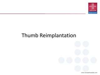 Thumb Reimplantation
 