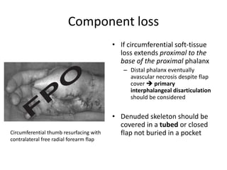 Component loss
• If circumferential soft-tissue
loss extends proximal to the
base of the proximal phalanx
– Distal phalanx eventually
avascular necrosis despite flap
cover  primary
interphalangeal disarticulation
should be considered
• Denuded skeleton should be
covered in a tubed or closed
flap not buried in a pocketCircumferential thumb resurfacing with
contralateral free radial forearm flap
 