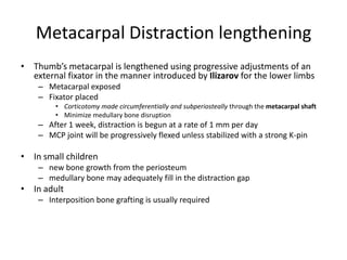 Metacarpal Distraction lengthening
• Thumb’s metacarpal is lengthened using progressive adjustments of an
external fixator in the manner introduced by Ilizarov for the lower limbs
– Metacarpal exposed
– Fixator placed
• Corticotomy made circumferentially and subperiosteally through the metacarpal shaft
• Minimize medullary bone disruption
– After 1 week, distraction is begun at a rate of 1 mm per day
– MCP joint will be progressively flexed unless stabilized with a strong K-pin
• In small children
– new bone growth from the periosteum
– medullary bone may adequately fill in the distraction gap
• In adult
– Interposition bone grafting is usually required
 
