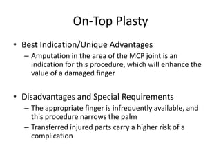 On-Top Plasty
• Best Indication/Unique Advantages
– Amputation in the area of the MCP joint is an
indication for this procedure, which will enhance the
value of a damaged finger
• Disadvantages and Special Requirements
– The appropriate finger is infrequently available, and
this procedure narrows the palm
– Transferred injured parts carry a higher risk of a
complication
 