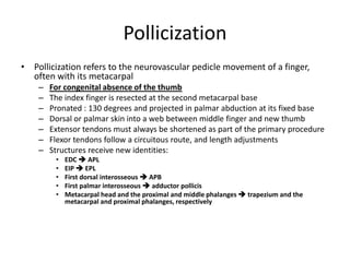 Pollicization
• Pollicization refers to the neurovascular pedicle movement of a finger,
often with its metacarpal
– For congenital absence of the thumb
– The index finger is resected at the second metacarpal base
– Pronated : 130 degrees and projected in palmar abduction at its fixed base
– Dorsal or palmar skin into a web between middle finger and new thumb
– Extensor tendons must always be shortened as part of the primary procedure
– Flexor tendons follow a circuitous route, and length adjustments
– Structures receive new identities:
• EDC  APL
• EIP  EPL
• First dorsal interosseous  APB
• First palmar interosseous  adductor pollicis
• Metacarpal head and the proximal and middle phalanges  trapezium and the
metacarpal and proximal phalanges, respectively
 