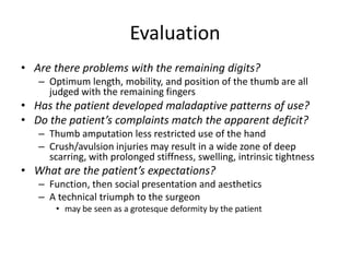 Evaluation
• Are there problems with the remaining digits?
– Optimum length, mobility, and position of the thumb are all
judged with the remaining fingers
• Has the patient developed maladaptive patterns of use?
• Do the patient’s complaints match the apparent deficit?
– Thumb amputation less restricted use of the hand
– Crush/avulsion injuries may result in a wide zone of deep
scarring, with prolonged stiffness, swelling, intrinsic tightness
• What are the patient’s expectations?
– Function, then social presentation and aesthetics
– A technical triumph to the surgeon
• may be seen as a grotesque deformity by the patient
 