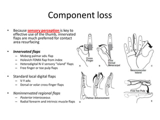 Component loss
• Because sensory perception is key to
effective use of the thumb, innervated
flaps are much preferred for contact
area resurfacing
• Innervated flaps
– Moberg palmar adv. flap
– Holevich FDMA flap from index
– Heterodigital N-V sensory “island” flaps
– Free finger or toe pulp flaps
• Standard local digital flaps
– V-Y adv.
– Dorsal or volar cross-finger flaps
• Noninnervated regional flaps
– Posterior interosseous
– Radial forearm and intrinsic muscle flaps
 