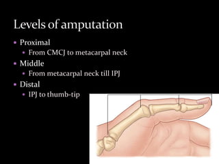Thumb reconstruction | PPTX