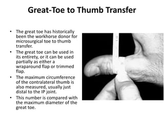 Thumb reconstruction by microvascular methods | PPTX