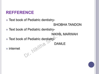 REFFERENCE
 Text book of Pediatric dentistry-
SHOBHA TANDON
 Text book of Pediatric dentistry-
NIKHIL MARWAH
 Text book of Pediatric dentistry-
DAMLE
 internet
 