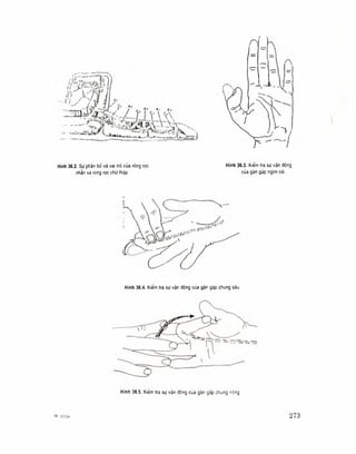 Hình 36.2. Sự phản bố và vai trò của ròng rọc
nhẩn và ròng rọc chữ thập
Hình 36.3. Kiểm tra sự vận động
của gán gấp ngón cái.
Hình 36.4. Kiểm tra sự vận động của gân gấp chung sâu.
Hình 36.5. Kiêm tra sự vận động cùa gàn gấp chung nòng
18 C1CH 273
 